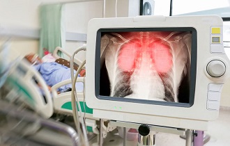 Статистика майского уикенда: чуть менее 3 тысяч новых случаев COVID-19 за сутки Статистика майского уикенда: чуть менее 3 тысяч новых случаев COVID-19 за сутки
