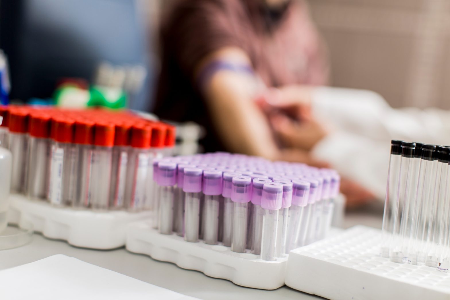 Як підготуватись до аналізу крові на аспартатамінотрансфераза (АСТ, AST)